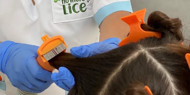 Say Goodbye To Lice: Effective Home Remedies For Lice Treatment